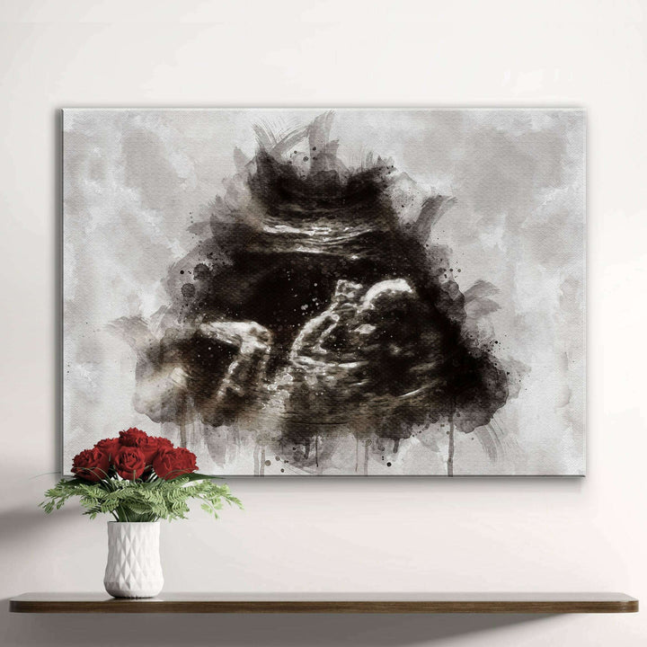 Custom Baby Ultrasound Watercolor Portrait